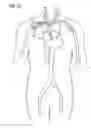 Fig. 09 - Introducer sheath