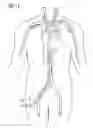 Fig. 10 - Introducer sheath