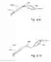 Fig. 30 - Devices, systems and methods useable for treating sinusitis