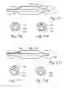 Fig. 35 - Devices, systems and methods useable for treating sinusitis