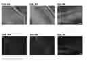 Fig. 07 - MICRONEEDLE ARRAYS FOR ACTIVE AGENT DELIVERY