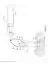 Fig. 04 - Leadless cardiac pacemaker with retrieval features