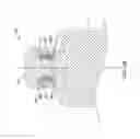 Fig. 12 - Leadless cardiac pacemaker with retrieval features