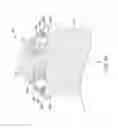 Fig. 16 - Leadless cardiac pacemaker with retrieval features