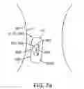 Fig. 12 - System and method for biphasic transdermal iontophoretic delivery of therapeutic agents for the control of addictive cravings