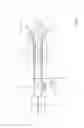 Fig. 02 - Handling and Control System for Expandable Electrodes of A Handpiece for Use in an Electro-Poration Process