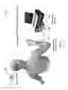 Fig. 02 - Flexible sheet for neuromuscular stimulation