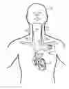 Fig. 01 - Implantable neurostimulator-implemented method for managing techyarrhythmia through vagus nerve stimulation