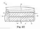 Fig. 05 - Method of fabricating a housing for an implantable medical device having integrated features