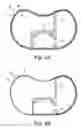 Fig. 06 - Method of fabricating a housing for an implantable medical device having integrated features