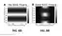 Fig. 09 - METHOD FOR OPTIMIZING RADIATION BEAM INTENSITY PROFILE SHAPE USING DUAL MULTIPLE APERTURE DEVICES
