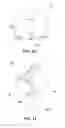 Fig. 12 - Hand cover apparatus