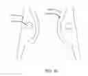 Fig. 08 - METHODS AND THIN WALLED REINFORCED STRUCTURES FOR ADDITIVE MANUFACTURING