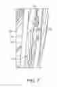 Fig. 08 - Lateral retention member