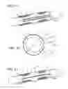 Fig. 02 - Circumferentially continuous and constrictable textile sleeve and method of construction thereof