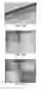 Fig. 09 - Advanced multi-element consumable-disposable products