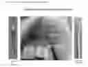 Fig. 02 - Methods for sampling gingival metabolites