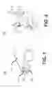 Fig. 02 - Lens and embedded optical element for near eye display