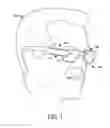 Fig. 02 - Smart eyewear with movable display