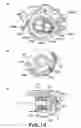 Fig. 11 - Rotational force transmitting part