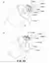 Fig. 90 - Rotational force transmitting part