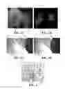 Fig. 03 - Feature characterization from infrared radiation