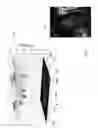 Fig. 14 - Intelligent multi-scale medical image landmark detection
