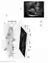 Fig. 15 - Intelligent multi-scale medical image landmark detection