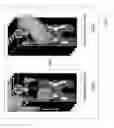 Fig. 27 - Intelligent multi-scale medical image landmark detection