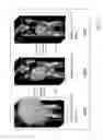 Fig. 28 - Intelligent multi-scale medical image landmark detection
