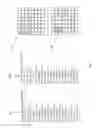 Fig. 05 - Core processes for block operations on an image processor having a two-dimensional execution lane array and a two-dimensional shift register