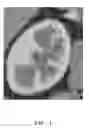 Fig. 02 - Method for determining the short axis in a lesion region in a three dimensional medical image