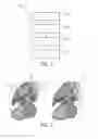 Fig. 02 - Medical image editing