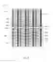 Fig. 09 - Self aligning imager array