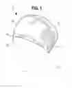 Fig. 02 - Surgical cap and method