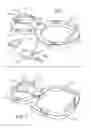 Fig. 02 - Jewelry enhancer