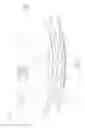 Fig. 07 - Infant carrier and motion device therewith