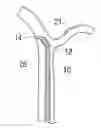 Fig. 01 - Medical device with distal torque control