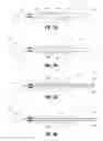 Fig. 07 - Medical device with distal torque control