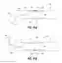 Fig. 10 - Medical device with distal torque control