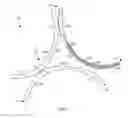 Fig. 02 - Retractable suture needle assembly