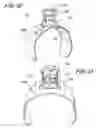 Fig. 06 - Adhesive pad and hemostasis system