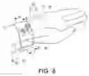 Fig. 09 - Hemostatic device