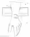 Fig. 02 - Surgical device