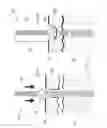 Fig. 07 - Bone compression and fixation devices