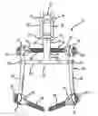 Fig. 01 - Spinal stabilization system