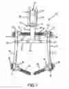 Fig. 02 - Spinal stabilization system