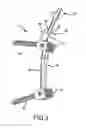 Fig. 04 - Spinal stabilization system