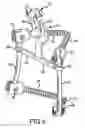 Fig. 06 - Spinal stabilization system