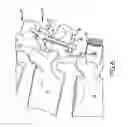 Fig. 07 - Spinal stabilization system